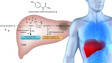 Paracetamol With Liver Damage