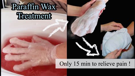 Paraffin Wax On Hands