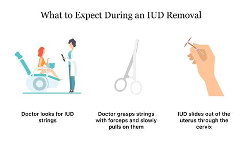 paragard iud removal side effects