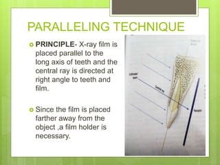 Parallel X-Ray Technique