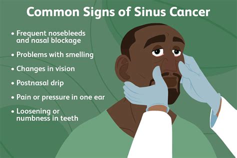 paranasal sinus cancer symptoms