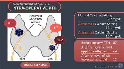 Unlocking Bone Health: The Parathormone Lab Test Explained