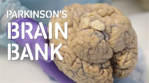 parkinson's brain bank