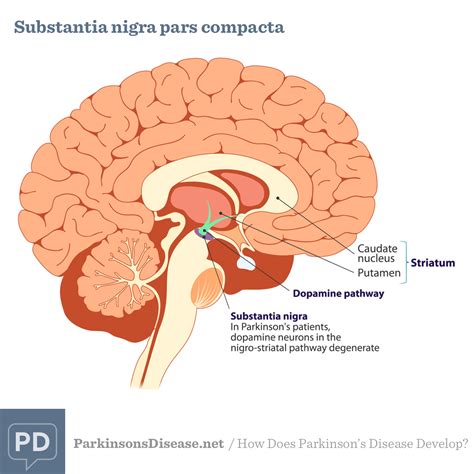 parkinson's disease brain area