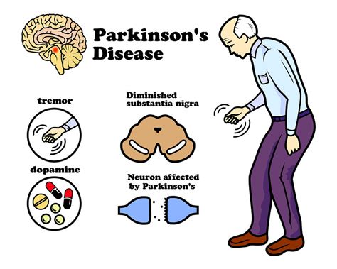 parkinson's disease seeing things