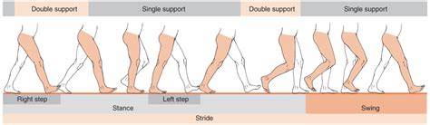 parkinson's gait type