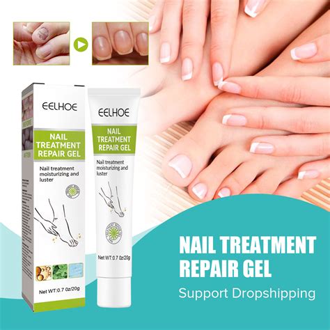 Effective Paronychia Treatment Cream for Quick Relief Available