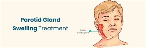 Parotid Gland Swelling: Causes, Symptoms, and Effective Treatments