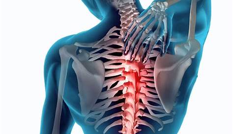 Dolor de espalda alta, te contamos 5 causas que pueden originarla