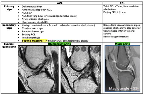 partial acl tear orthobullets