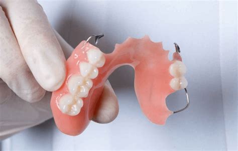 Partial Removable Denture Cost
