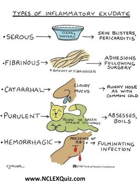 partially obscuring inflammatory exudate