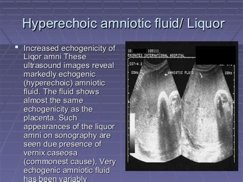 Particles In Amniotic Fluid Third Trimester