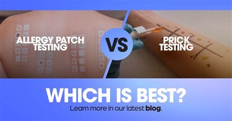 Patch Testing Vs Prick Testing