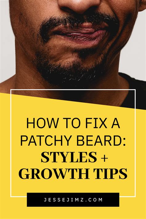 Patches Beard Meaning