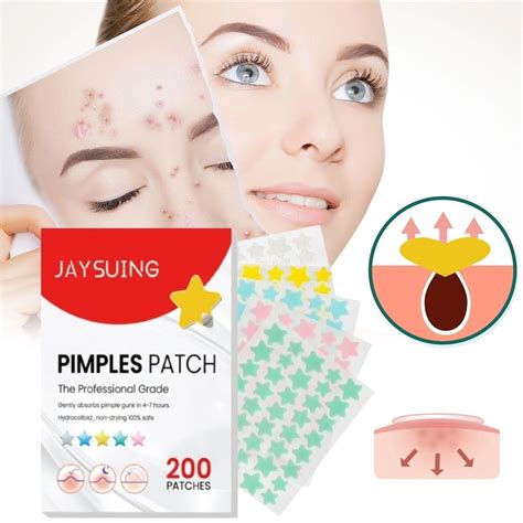 Patches For Zits