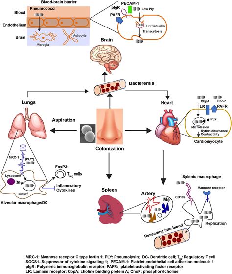 pathogenesis of streptococcus pneumoniae