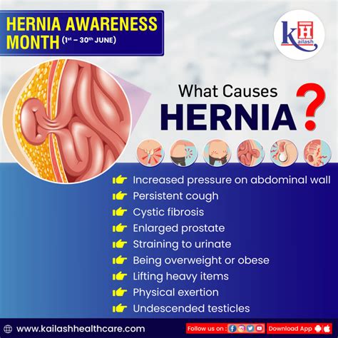 pathophysiology of a hernia