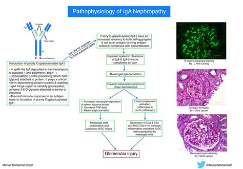 pathophysiology of iga nephropathy
