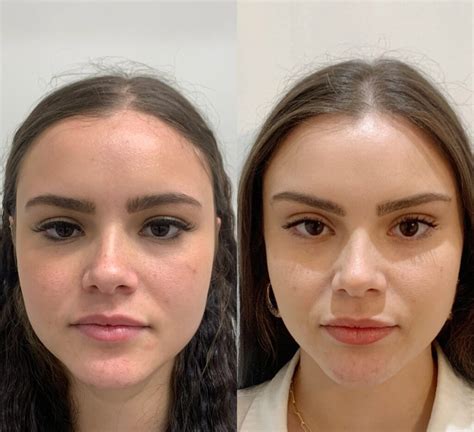 Pdo Threads Before And After Eyebrows