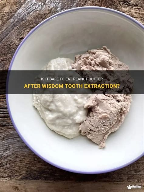 Peanut Butter Tooth Extraction