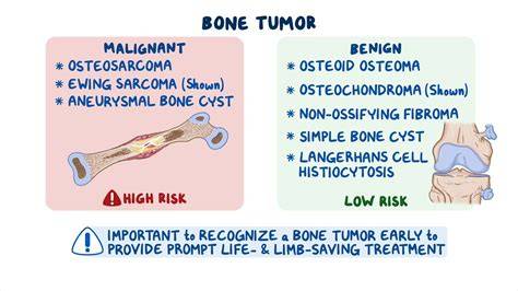 Radiology of Bone Tumors ABC = Aneurysmal bone cyst CMF = Chondromyxoid
