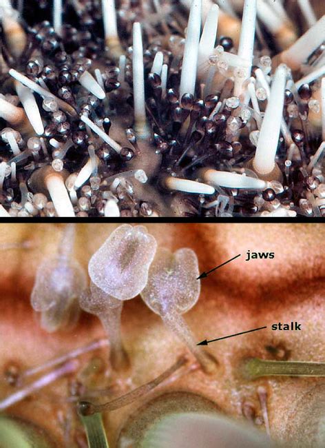 Pediselaria Adalah – Segala Hal yang Perlu Anda Ketahui