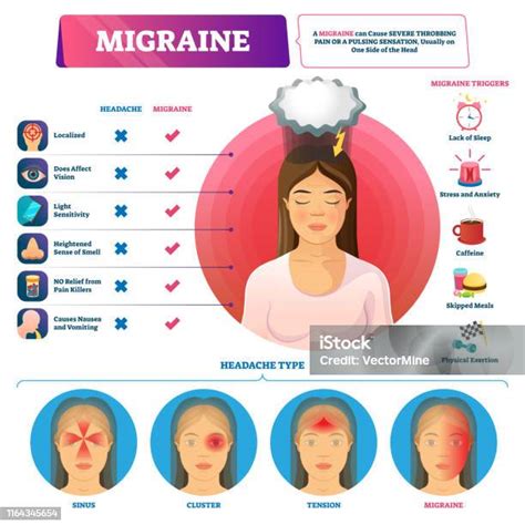 Menghindari Pemicu Migrain