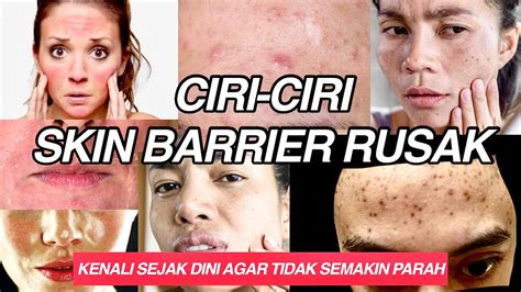 pencegahan skin barrier rusak
