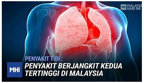 Penyakit Tibi, Penyakit Berjangkit Kedua Tertinggi Di Malaysia | MHI