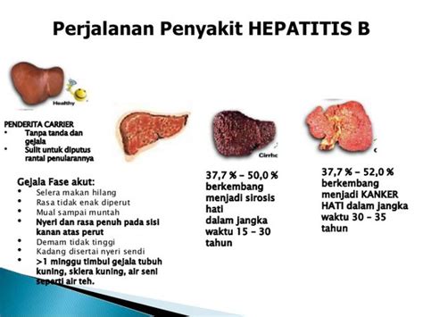 penyakit hepatitis disebabkan oleh