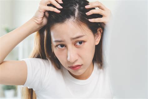 penyebab rambut rontok parah pada wanita