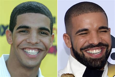 people with and without beards