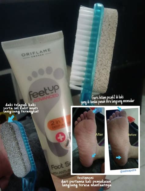 Cara Ampuh Atasi Kaki Pecah-pecah dengan Perawatan Oriflame