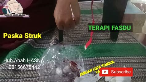 perawatan paska smoothing