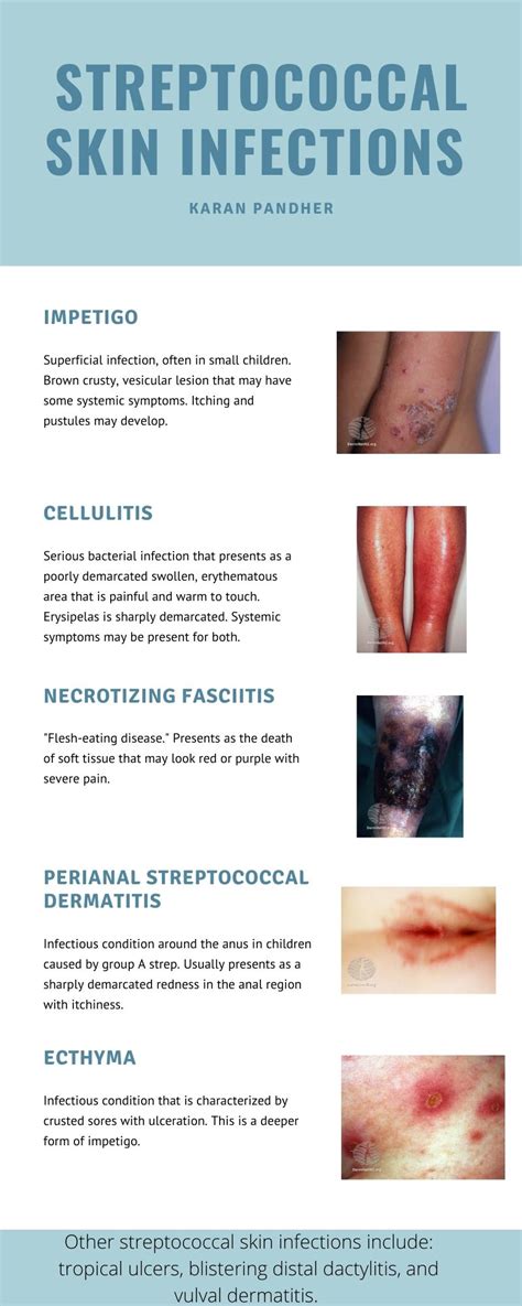 Understanding Perianal Streptococcal Dermatitis: Causes and Effective Treatments