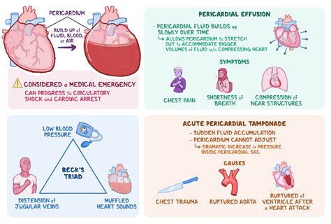 pericardial tamponade signs