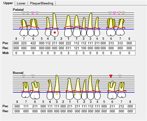 Perio Probe Numbers