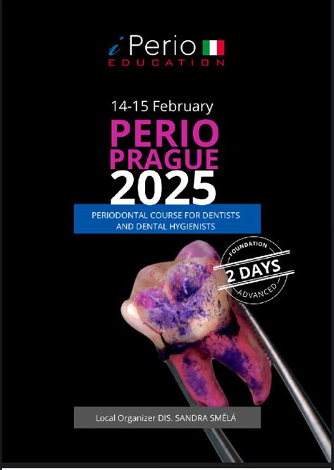 perio sdn 2025