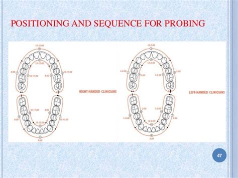 Periodontal Probing Sequence