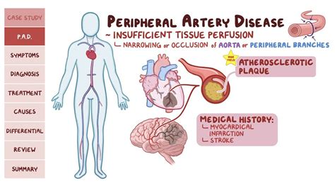 Understanding Peripheral Heart Disease: Causes, Symptoms, and Treatments