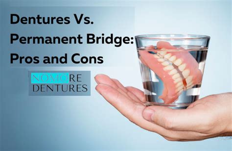 permanent bridge pros and cons