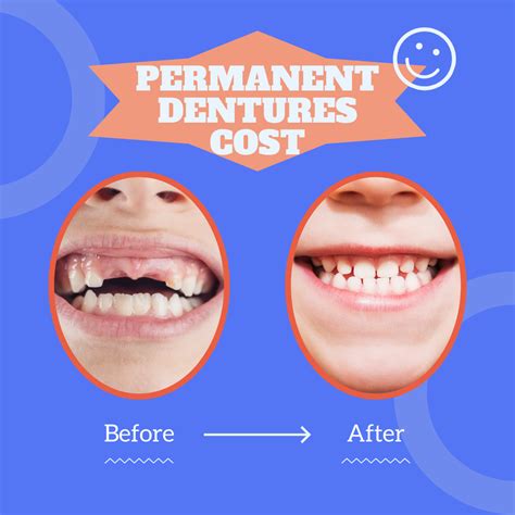 Permanent Dentures Cost In Mexico