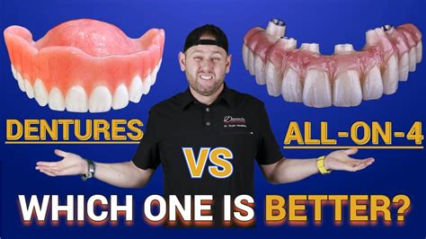 Permanent Dentures Vs Snap In Dentures