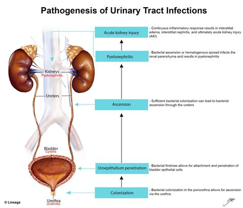 persistent urinary tract infection