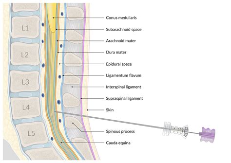 perverted punctured and pierced
