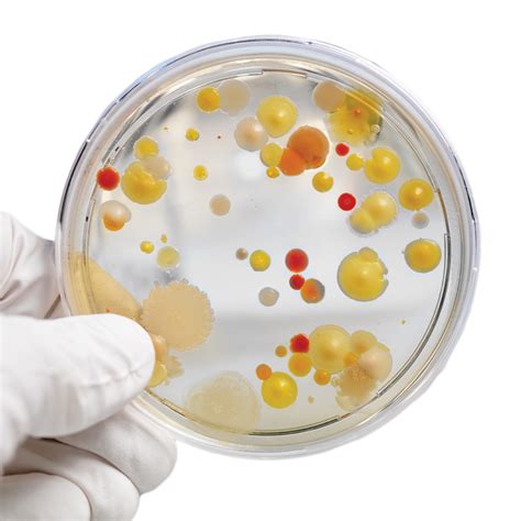petri dish bacteria experiment