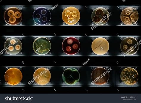 Petri Dish Bacteria Identification Chart