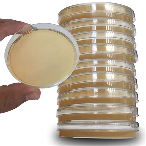 petri dishes with agar