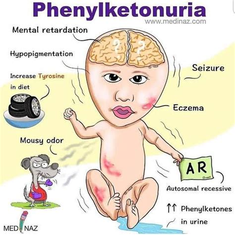 Phenylketonuria Is An Example Of